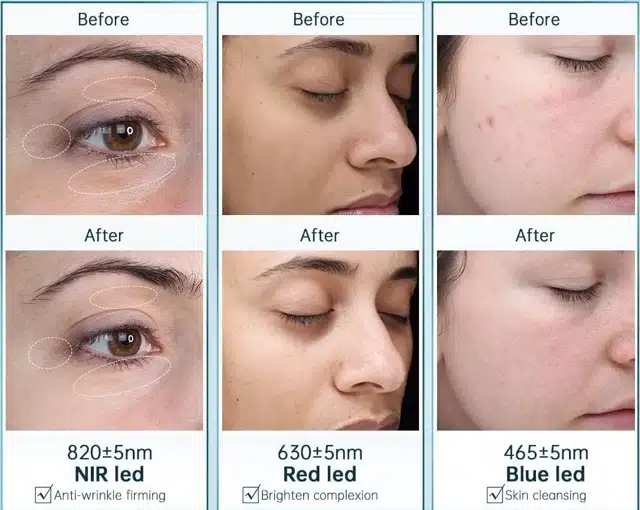 mascara facial luz led